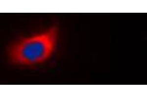 Immunofluorescent analysis of mGLUR5 staining in EOC20 cells.