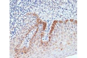 Immunohistochemistry of paraffin-embedded Human tonsil using CXCL12 Polyclonal Antibody at dilution of 1:100 (40x lens).