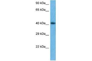 WB Suggested Anti-IKZF5 antibody Titration: 1 ug/mL Sample Type: Human THP-1 Whole Cell