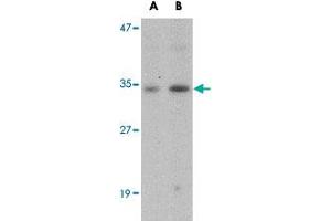 Western blot analysis of GNPDA1 in mouse kidney tissue lysate with GNPDA1 polyclonal antibody  at (A) 1 and (B) 2 ug/mL . (GNPDA1 抗体  (C-Term))