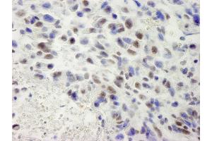 Immunohistochemistry (IHC) image for anti-hSET1 (AA 1200-1250) antibody (ABIN7448601) (hSET1 (AA 1200-1250) 抗体)