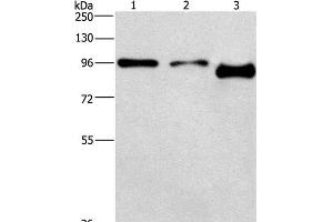 Western Blot analysis of A431 and hela cell,Mouse brain tissue using PIP5K1C Polyclonal Antibody at dilution of 1:500 (PIP5K1C 抗体)