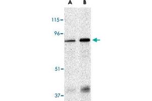 Western blot analysis of EIF2AK2 in Caco-2 whole cell lysate with EIF2AK2 polyclonal antibody  at (A) 1 and (B) 2 ug/mL . (EIF2AK2 抗体  (N-Term))
