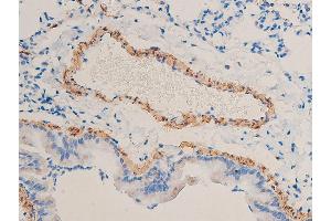 Immunohistochemistry (IHC) image for anti-Actin, alpha 2, Smooth Muscle, Aorta (ACTA2) (N-Term) antibody (ABIN6254917)