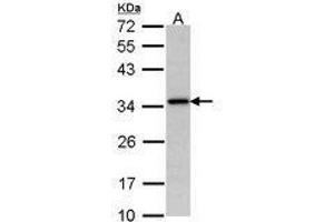 Image no. 1 for anti-N-Acetyltransferase 1 (Arylamine N-Acetyltransferase) (NAT1) (AA 1-157) antibody (ABIN467615) (NAT1 抗体  (AA 1-157))