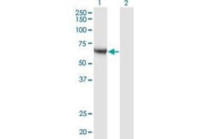 Western Blot analysis of CAMKK1 expression in transfected 293T cell line by CAMKK1 monoclonal antibody (M04), clone 4A11. (CAMKK1 抗体  (AA 2-100))