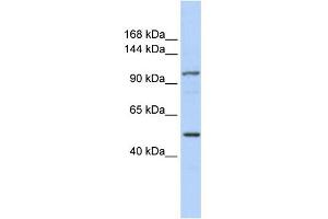 WB Suggested Anti-KIAA1618 Antibody Titration:  0. (RNF213 抗体  (N-Term))
