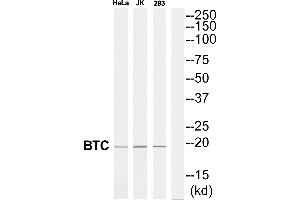 Western blot analysis of extracts from 293/Jurkat/HeLa cells, using BTC antibody. (Betacellulin 抗体  (Internal Region))