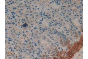 Used in DAB staining on fromalin fixed paraffin- embedded spleen tissue (FABP2 抗体  (AA 2-132))