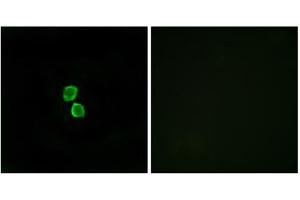 Immunofluorescence analysis of MCF-7 cells, using CKLF1 antibody. (CMTM1 抗体  (C-Term))