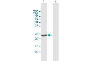 Western Blot analysis of DTYMK expression in transfected 293T cell line by DTYMK MaxPab polyclonal antibody. (DTYMK 抗体  (AA 1-212))
