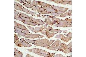 Immunohistochemical analysis of Beta2A-tubulin staining in mouse skeletal muscle formalin fixed paraffin embedded tissue section. (TUBB2A 抗体)