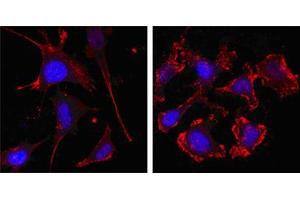 Confocal immunofluorescence analysis of SKBR-3 (left) and A549 (right) cells using beta Actin mouse mAb (red, the secondary Ab is Cy3-Goat anti mouse IgG). (beta Actin 抗体  (N-Term))
