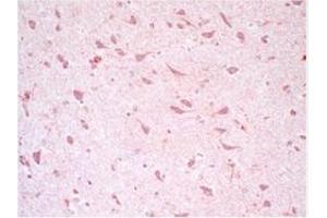 Immunohistochemistry (IHC) image for anti-Frataxin (FXN) antibody (ABIN781667) (Frataxin 抗体)