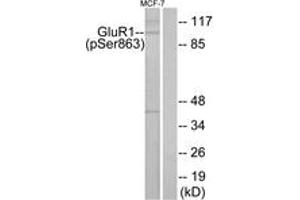 Western blot analysis of extracts from MCF-7 cells, using GluR1 (Phospho-Ser863) Antibody. (Glutamate Receptor 1 抗体  (pSer863))
