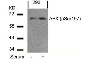 Western blot analysis of extracts from 293 cells untreated or treated with serum using AFX(Phospho-Ser197) Antibody. (FOXO4 抗体  (pSer197))