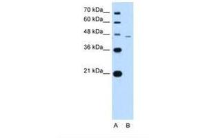 Image no. 1 for anti-SMAD, Mothers Against DPP Homolog 7 (SMAD7) (N-Term) antibody (ABIN324250) (SMAD7 抗体  (N-Term))
