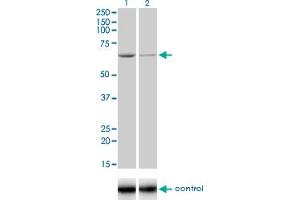 Western blot analysis of ADPGK over-expressed 293 cell line, cotransfected with ADPGK Validated Chimera RNAi (Lane 2) or non-transfected control (Lane 1).
