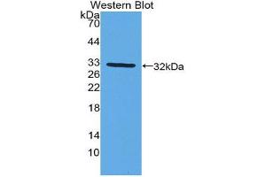 Western Blotting (WB) image for anti-Cytochrome P450, Family 27, Subfamily B, Polypeptide 1 (CYP27B1) (AA 256-508) antibody (ABIN1858592) (CYP27B1 抗体  (AA 256-508))