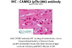 Image no. 1 for anti-Calcium/calmodulin-Dependent Protein Kinase II beta (CAMK2B) (pThr286) antibody (ABIN1732578) (CAMK2B 抗体  (pThr286))