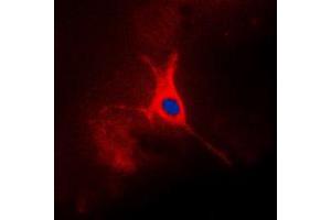 Immunofluorescent analysis of TACSTD2 staining in A549 cells. (TACSTD2 抗体  (Center))