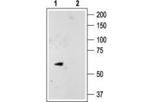 Western blot analysis of rat cerebellum lysate: - 1. (KCNK10 抗体  (C-Term, Intracellular))