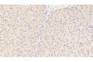 Immunohistochemistry (IHC) image for anti-Aconitase 1 (ACO1) (AA 26-243) antibody (ABIN7436732)