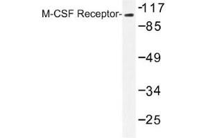 Image no. 1 for anti-Colony Stimulating Factor 1 Receptor (CSF1R) antibody (ABIN317880) (CSF1R 抗体)