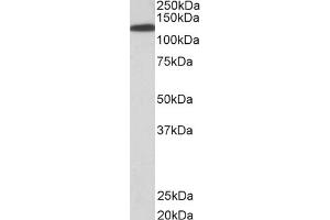 Western Blotting (WB) image for anti-Kinesin Family Member 5B (KIF5B) (C-Term) antibody (ABIN184774)