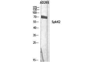 Western Blotting (WB) image for anti-Sphingosine Kinase 2 (SPHK2) (Tyr754) antibody (ABIN3187037)