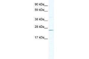 WB Suggested Anti-DNAJC17 Antibody Titration:  2. (DNAJC17 抗体  (N-Term))