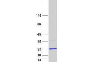 Validation with Western Blot