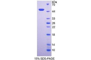 SDS-PAGE analysis of Human NCF1 Protein. (NCF1 蛋白)