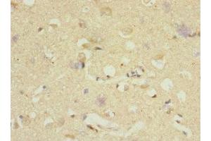 Immunohistochemistry of paraffin-embedded human brain tissue using ABIN7150518 at dilution of 1:100 (DNAJB2 抗体  (AA 215-324))