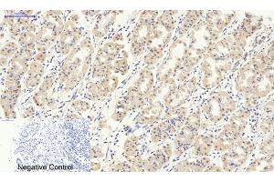 anti-Smad2/3 Transcription Factor (SMAD2/3) antibody