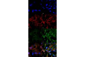 Immunocytochemistry/Immunofluorescence analysis using Mouse Anti-Acrolein Monoclonal Antibody, Clone 2H2 . (Acrolein 抗体  (APC))