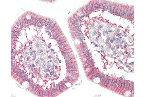 Immunohistochemistry (IHC) image for anti-Solute Carrier Family 7 (Amino Acid Transporter, L-Type), Member 8 (SLC7A8) antibody (ABIN2571723)