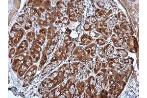 IHC-P Image CRHSP-24 antibody [N1C3] detects CRHSP-24 protein at cytoplasm in mouse prostate by immunohistochemical analysis. (CARHSP1 抗体)