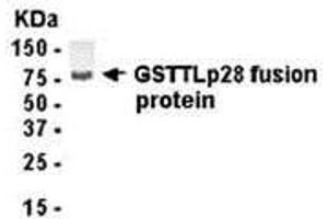 Western Blotting (WB) image for anti-Glutathione S-Transferase omega 1 (GSTO1) (AA 1-241) antibody (ABIN2468060) (GSTO1 抗体  (AA 1-241))