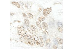 Immunohistochemistry (IHC) image for anti-SET Domain Containing 1B (SETD1B) (AA 350-400) antibody (ABIN7448602) (SETD1B 抗体  (AA 350-400))