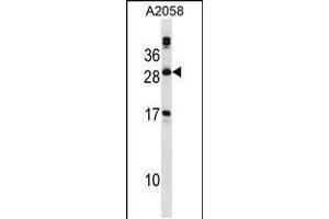 Western blot analysis in A2058 cell line lysates (35ug/lane). (PLA2G12A 抗体  (AA 55-83))