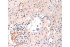 Used in DAB staining on fromalin fixed paraffin- embedded Kidney tissue (ANGPTL4 抗体  (AA 228-389))
