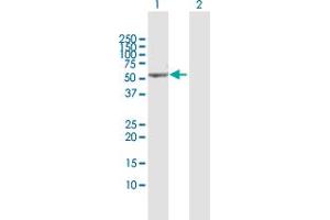 Western Blot analysis of VRK2 expression in transfected 293T cell line by VRK2 MaxPab polyclonal antibody. (VRK2 抗体  (AA 1-508))