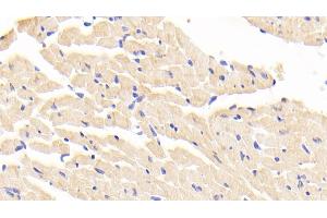 Detection of LTA4H in Mouse Cardiac Muscle Tissue using Polyclonal Antibody to Leukotriene A4 Hydrolase (LTA4H) (LTA4H 抗体  (AA 135-272))