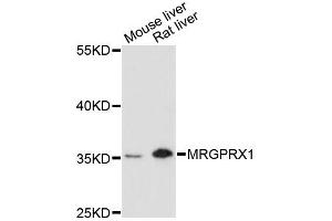 Western blot analysis of extracts of various cell lines, using MRGPRX1 antibody (ABIN6293323) at 1:3000 dilution. (MRGPRX1 抗体)