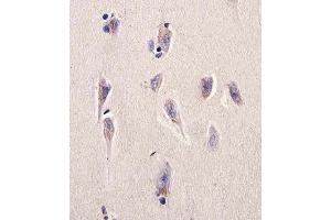 Immunohistochemical analysis of paraffin-embedded H. (Dihydrofolate Reductase 抗体  (N-Term))
