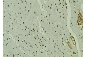 ABIN6277684 at 1/100 staining Mouse muscle tissue by IHC-P. (PPARD 抗体  (C-Term))