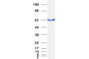 Western Blotting (WB) image for Adenylate Kinase 5 (AK5) (Transcript Variant 1) protein (Myc-DYKDDDDK Tag) (ABIN2714407)