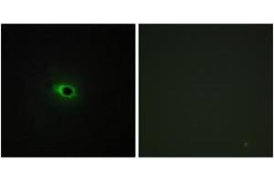 Immunofluorescence analysis of COS7 cells, using Collagen XII alpha1 Antibody. (COL12A1 抗体  (AA 1481-1530))