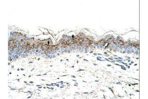 Image no. 1 for anti-GTP Binding Protein Overexpressed in Skeletal Muscle (GEM) (AA 219-270) antibody (ABIN203412) (GEM 抗体  (AA 219-270))